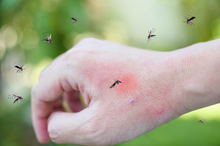 Allergies and Pests- Pest control services